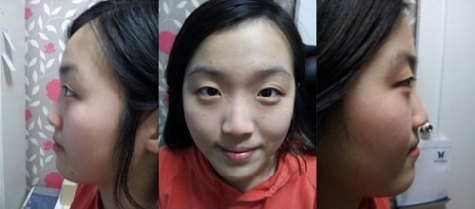 ȥ�������������۾�+����