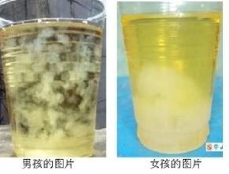 我个人<em>觉得</em>所以测胎儿<em>性别</em>最靠谱的一个方法!