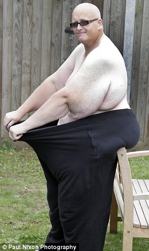世界最胖男子减重250公斤 致皮肤下垂(组图)