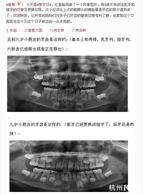 乳牙和恒牙的区别乳牙和恒牙的区别图片