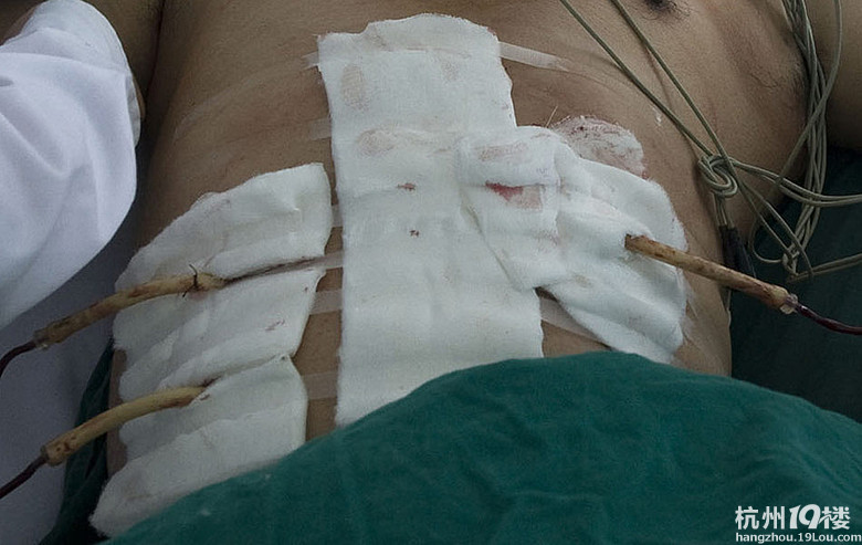 暗恋生恨 大叔捅死18岁少女切腹自尽(图)-湖州消息-湖州19楼