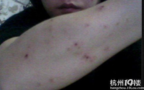 怀孕4个半月,身上奇痒无比-准妈妈论坛-杭州19