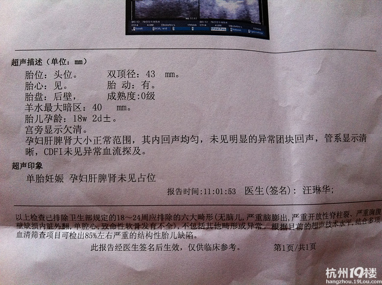 孕17周产检-孕中期(13-28周)-准妈妈论坛-杭州