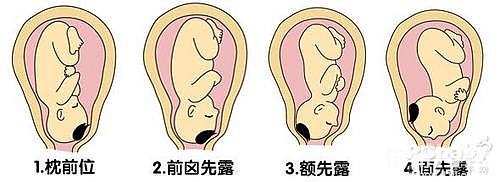 學(xué)會撫摸胎寶寶的位置（圖）