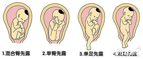 學(xué)會撫摸胎寶寶的位置（圖）