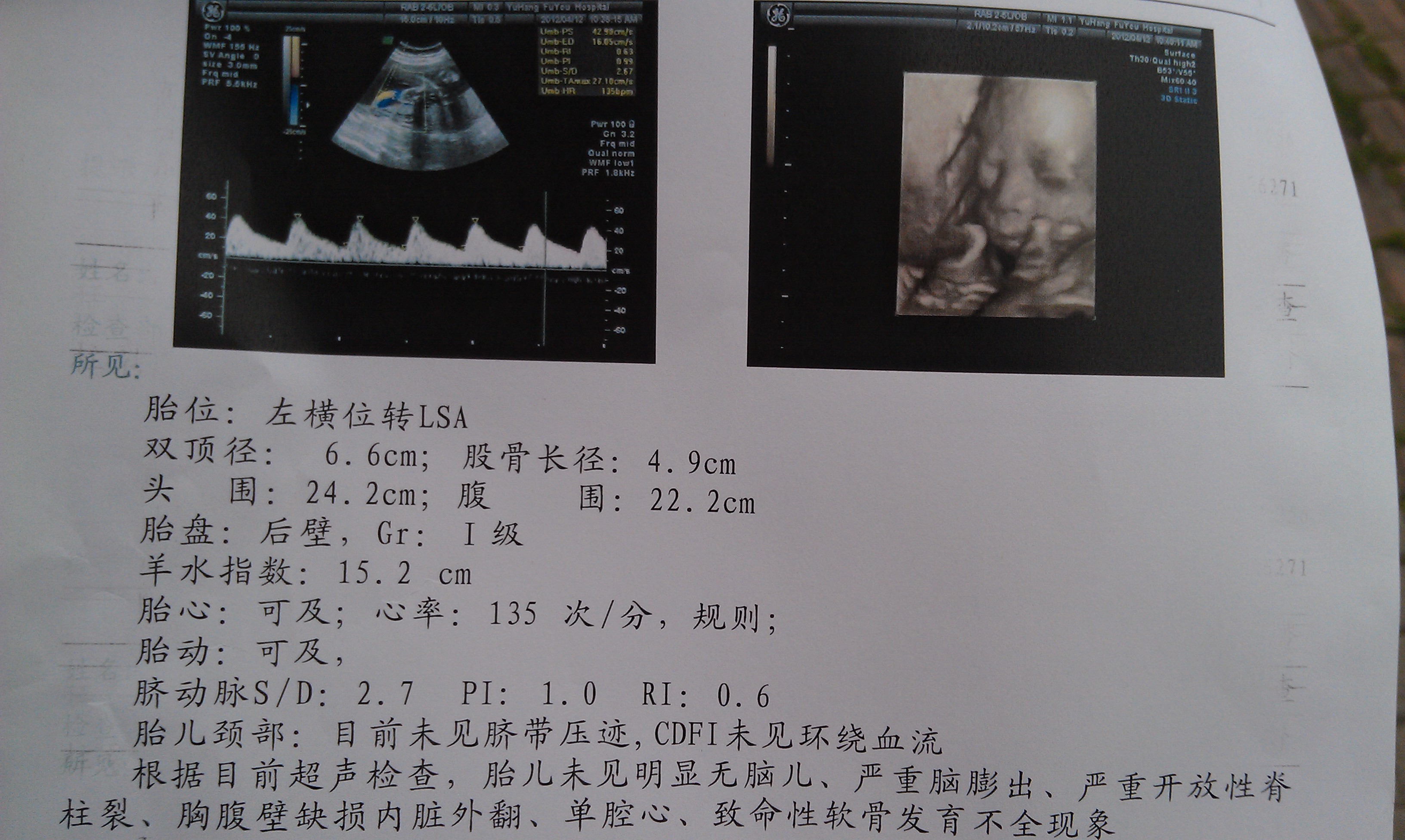 生命奇迹！创桂林纪录！23周+4天超早产儿平安出院_康康_团队_皮肤
