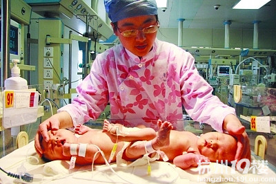 醫(yī)院為連體姐妹成功分身(組圖)