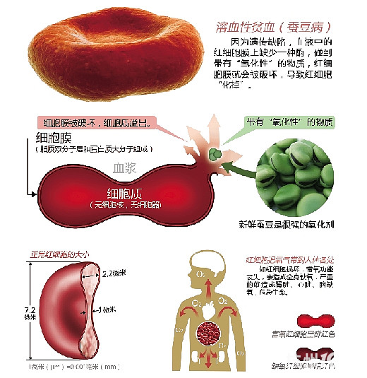 14个月大的<em>宝宝</em>连吃两天蚕豆 突发蚕豆病差点