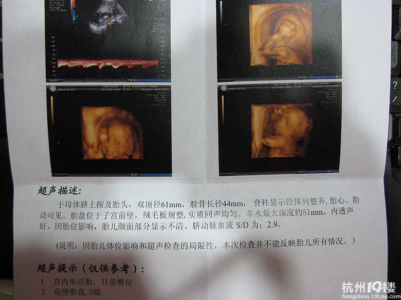 省人民医院三维归来-准妈妈论坛-杭州19楼