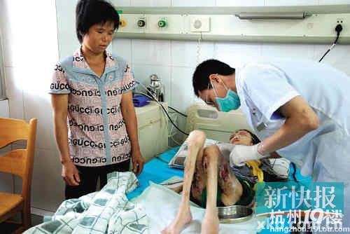 花季<em>少女</em>罕见<em>皮肤病</em>瘦成二十多斤 医院不敢救