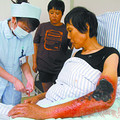 宁波有人感染创伤弧菌性命垂危 -公社之家-杭州