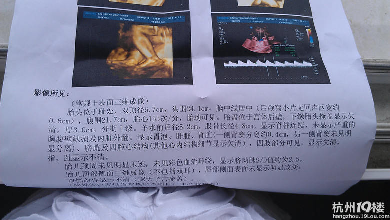 8月31日117医院三维b超归来-准妈妈论坛-杭州