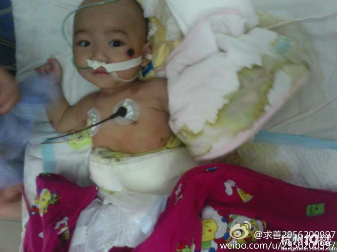 六个月的刘浩然宝宝需要广大爱心人士的帮助!