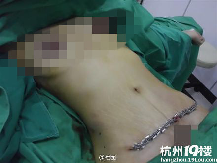 <em>女人</em>生完孩子就是毁容-准妈妈论坛-杭州19楼