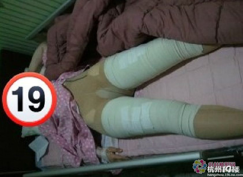 摆脱了“大象腿”！她更自信了！_图1