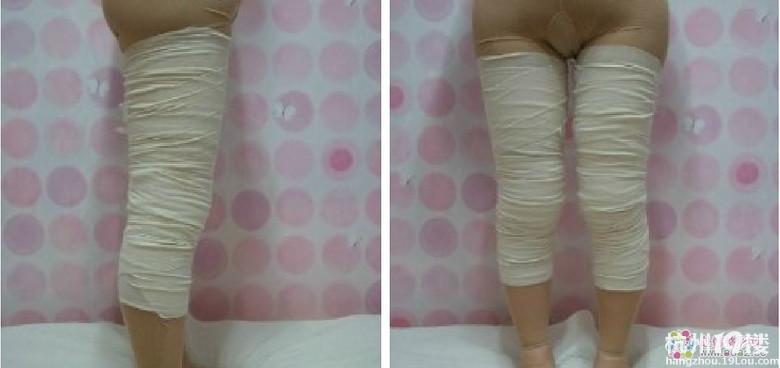 摆脱了“大象腿”！她更自信了！_图2
