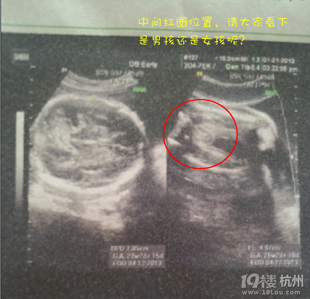 怀孕27周彩超图像帮忙看男女-准妈妈论坛-杭州