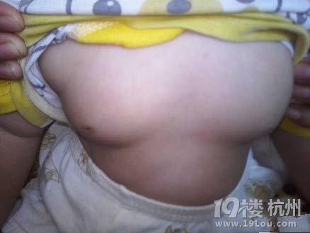 <em>喝</em>雅*<em>奶粉</em>一个月1岁小女孩性早熟?-妈咪课堂