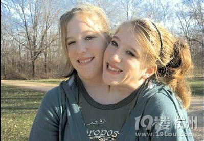 美连体姐妹大学毕业将任教师 领一份工资-职场