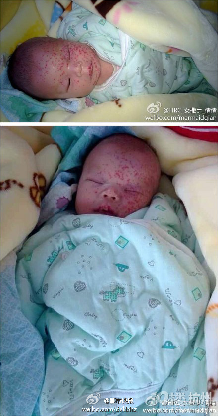 鄭州未滿月女嬰遭棄 臉上爬滿螞蟻傷痕累累(圖)
