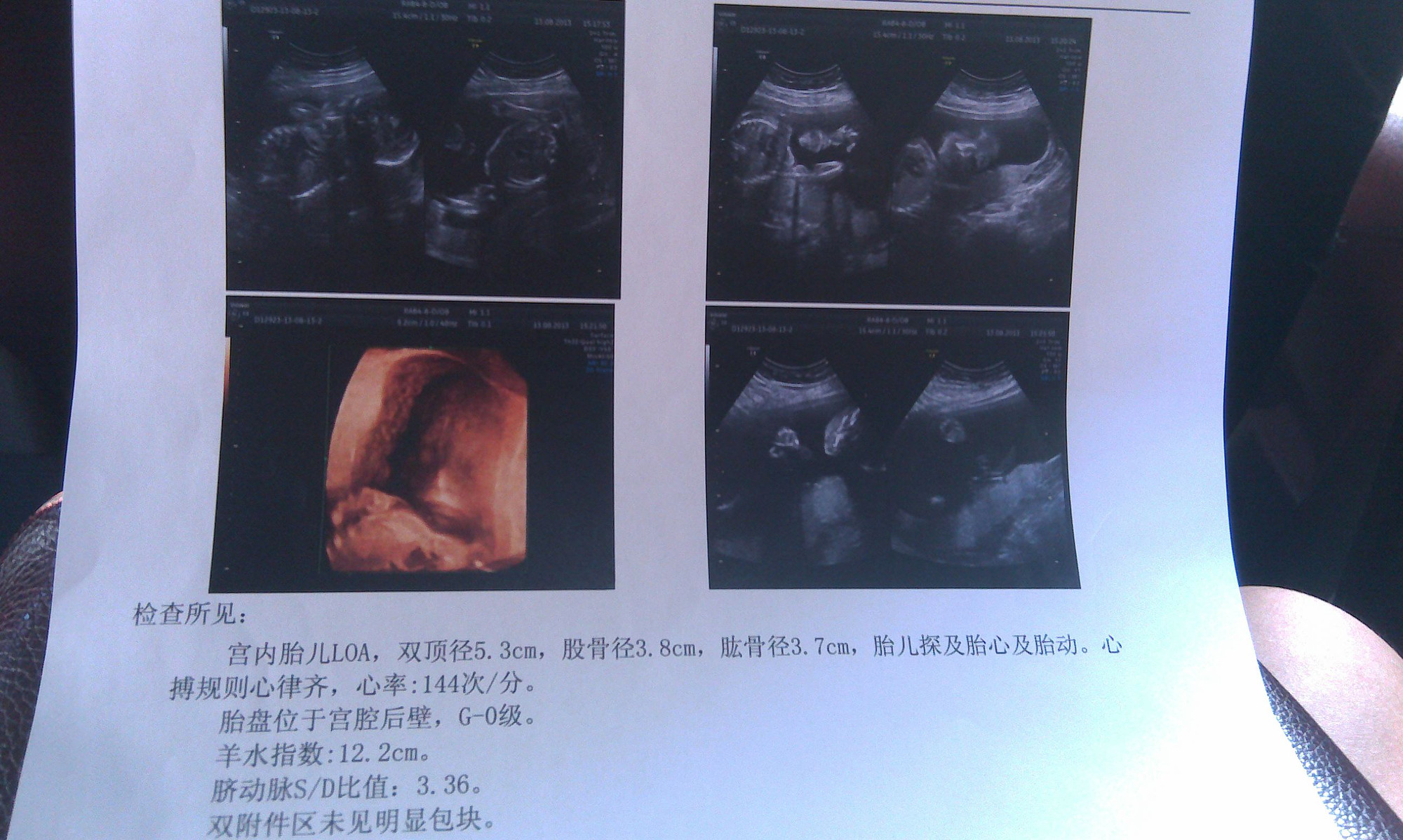 三维b超猜猜男宝女宝