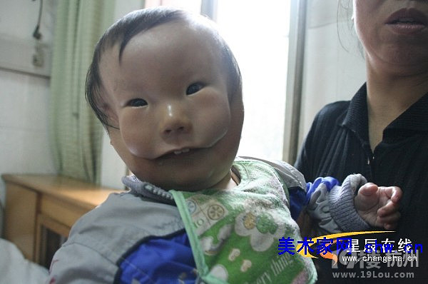 离预产期还有半个月 准妈妈嚷着要提前剖-第4