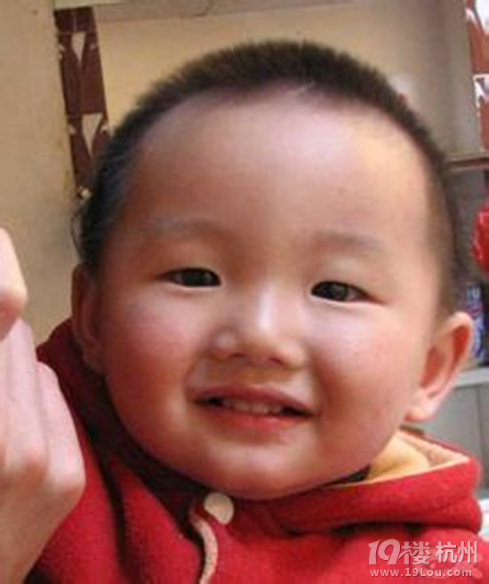小兒發(fā)燒抽筋的表現(xiàn)有哪些？