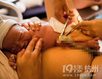 臍帶血保存費用
