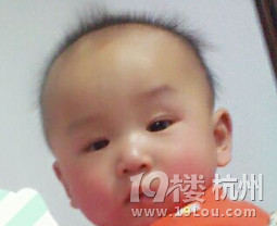 宝<em>头发</em>又<em>黄</em>又希-<em>婴儿</em>期(1-12个月)-孩爸孩妈聊