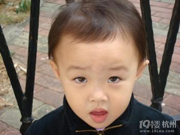 宝宝斗鸡眼怎么办-家事百科-孩爸孩妈聊天室-杭