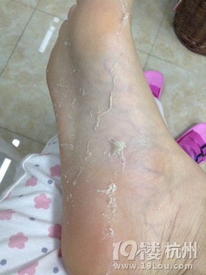 足部脱死皮, 美美得穿高跟~-Shopping帮-杭州19楼