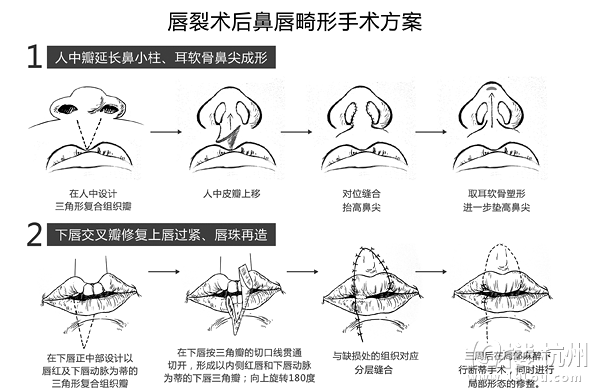90ѽ沿ޏ(f)g(sh)ɹ