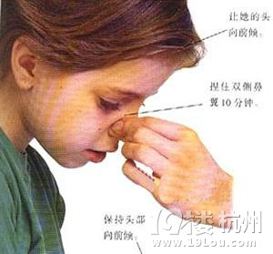 孩子经常流鼻血怎么办?预防孩子流鼻血!-家事
