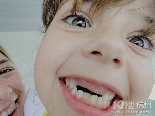 小孩换牙长歪了怎么办?家长们你们是怎么解决