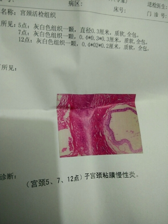 来姨妈乳房涨痛原来是这原因?妇科专家来帮你