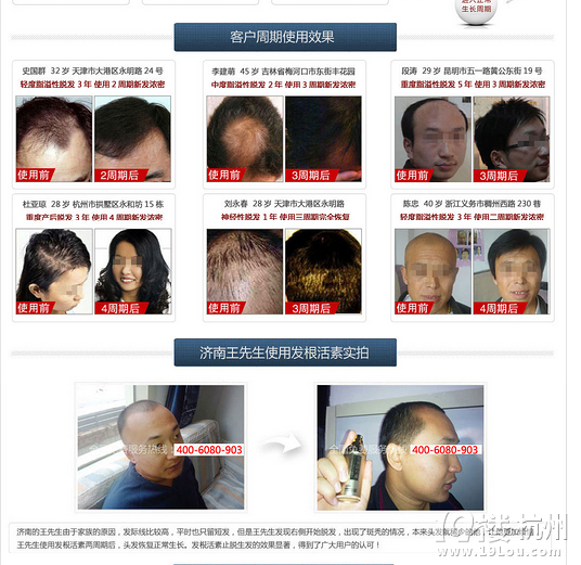 秃大夫发根活力素真的管用吗-Shopping帮-杭州