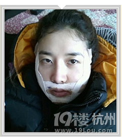 凸嘴的人是否有同感?-整容-美容护肤-杭州19楼