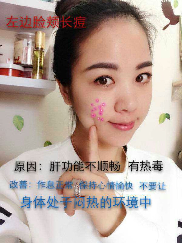 长痘位置透露你的
