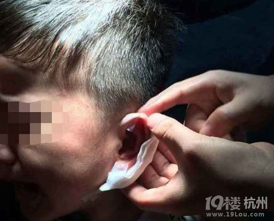 现“订书针门” 怎让孩远离坏老师伤害?