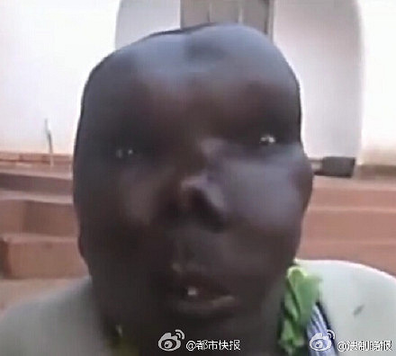 乌干达最丑男子靠脸吃饭:已生8个孩子-其他-