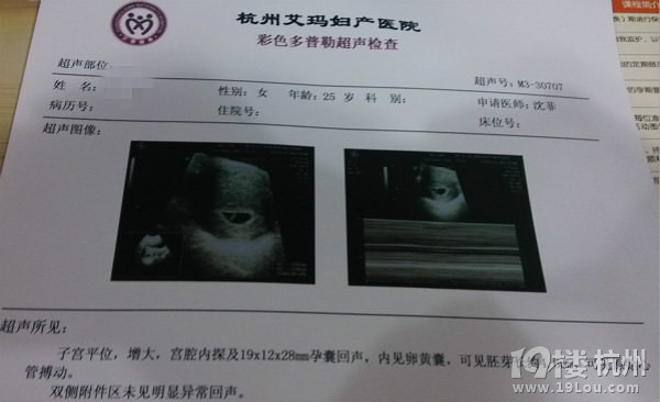 我的小猴子，終于B超看到你啦！艾瑪早孕檢查順利通過