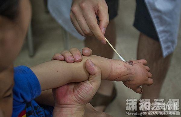 長(zhǎng)沙3歲幼童乘扶梯時(shí)跌倒 手部卷入踏板縫隙