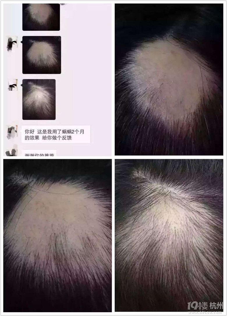 蜗蜗洗发水防脱效果怎么样?好不好?蜗蜗洗发