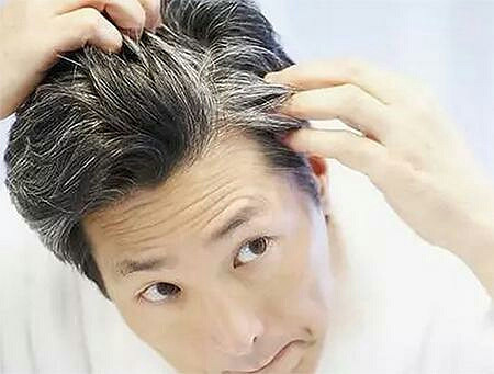 从白发位置看五脏健康 长白发其实是对身-健康