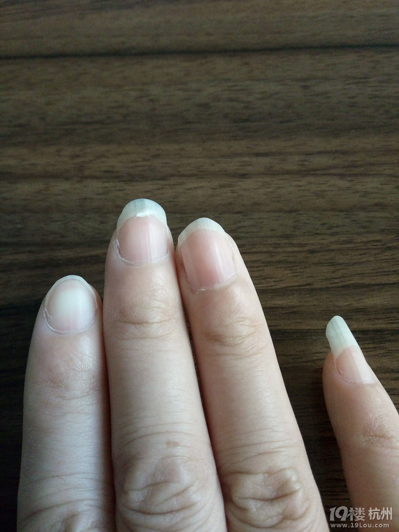 手指甲上有白点代表什么,透过指甲看健康!-健康