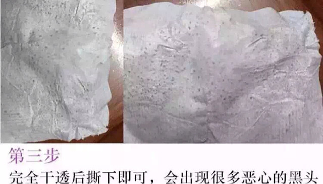 【 泰国芦荟去黑头】强烈推荐加v