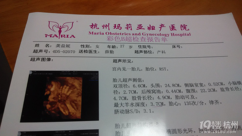 杭州马莉亚医院怀孕四维拍照-孕中期(13-28周