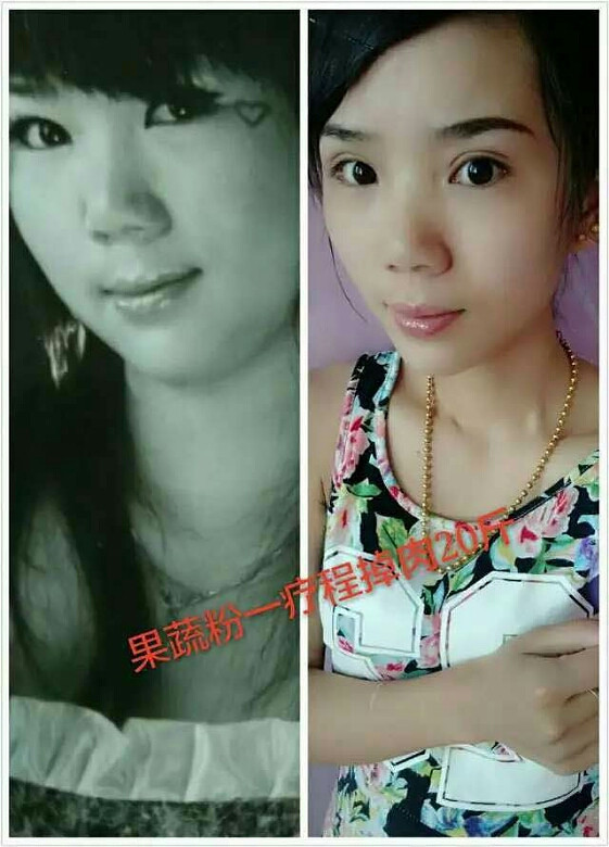 酵素减肥哪个品牌效果最好?对身体有伤害吗?