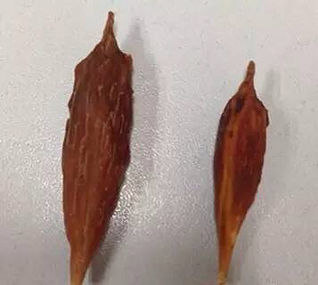 一颗红枣害得3岁女孩失去了8cm小肠!杭-小学