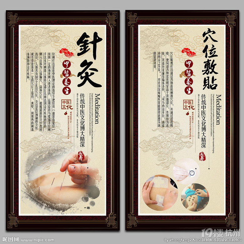 成都中医针灸点穴减肥 好处有什么? 薇莘cd-gy